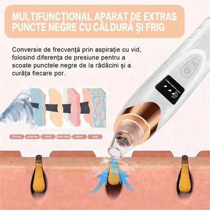 Dispozitiv Electric Îndepărtare Puncte Negre și Curățare Pori - 5 Niveluri Aspirație + CADOU INCLUS!
